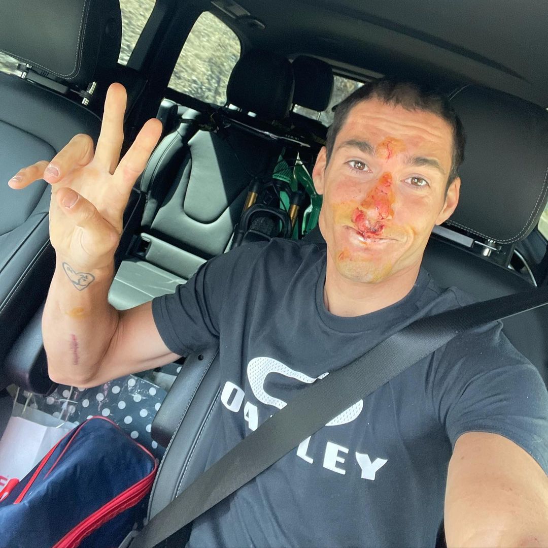 Espargaro grazed after cycling accident